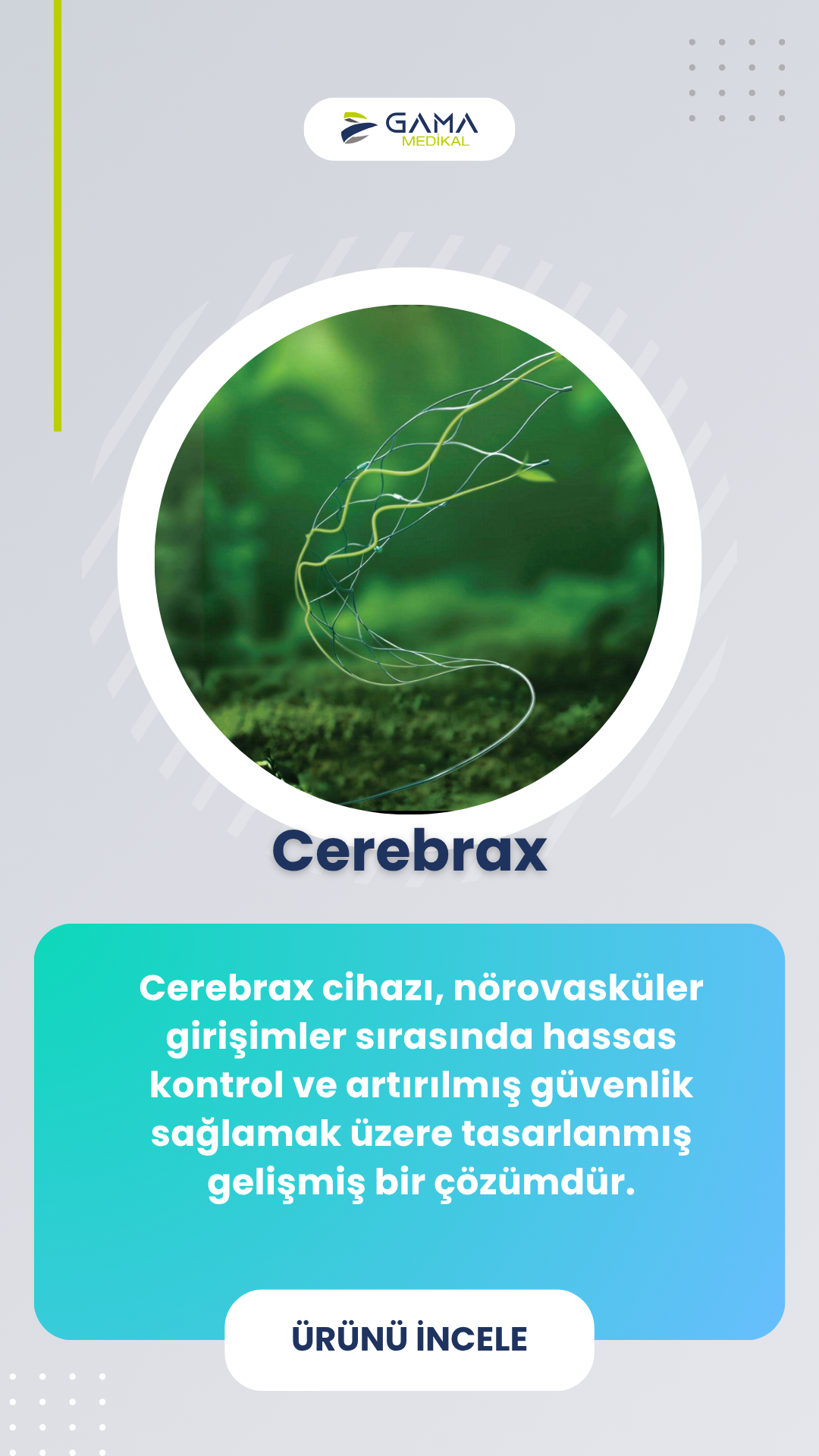 Stent Retriever