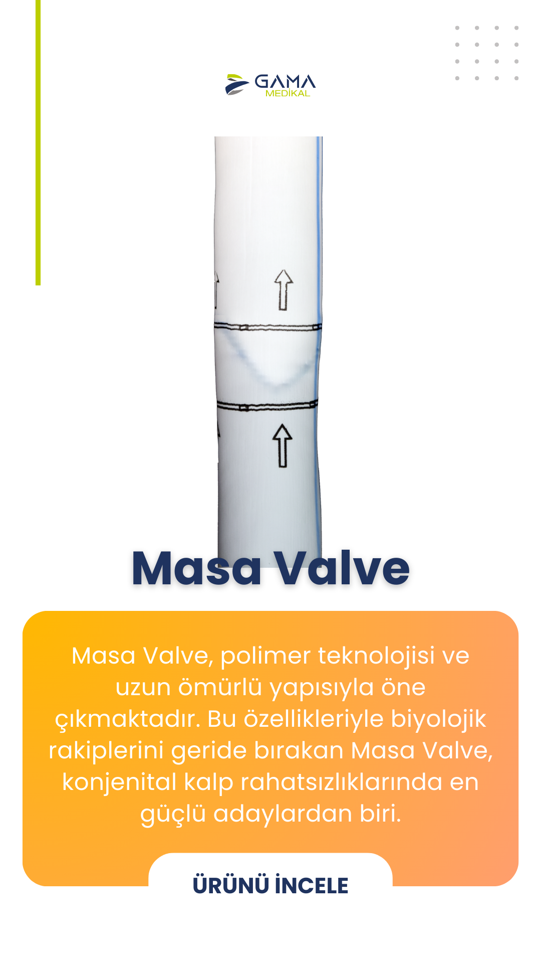 Masa Valve