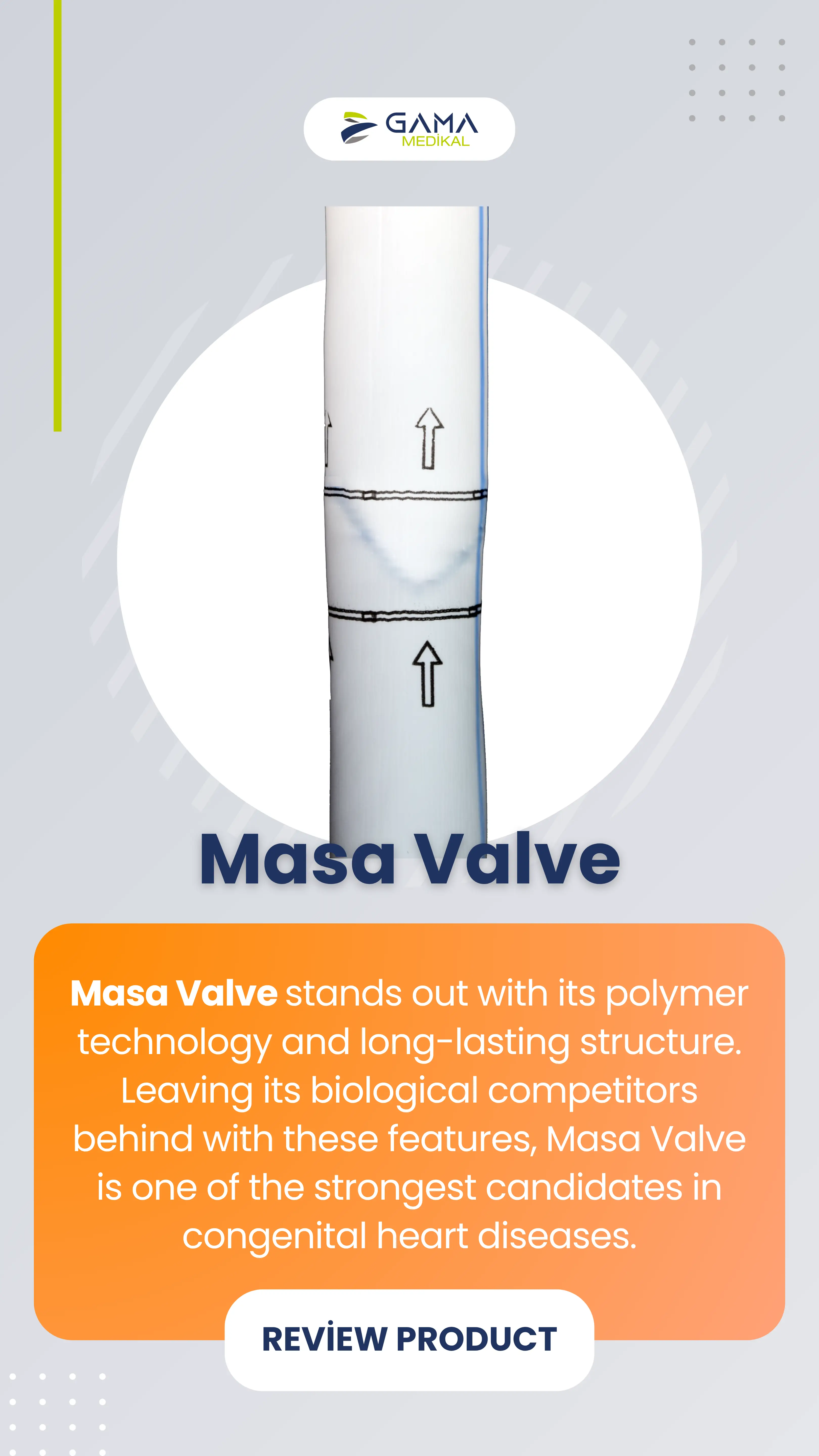 Masa Valve