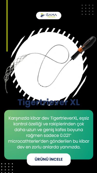 TigertrieverXL